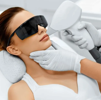 Laser By Tako Laser By Tako